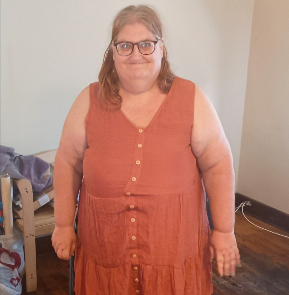 Stacy's story